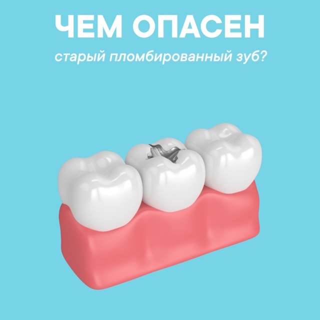 Чем опасен «старый пломбированный зуб»? Чем опасен «старый пломбированный зуб»?